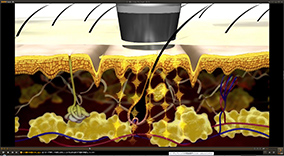 Electroporation Image